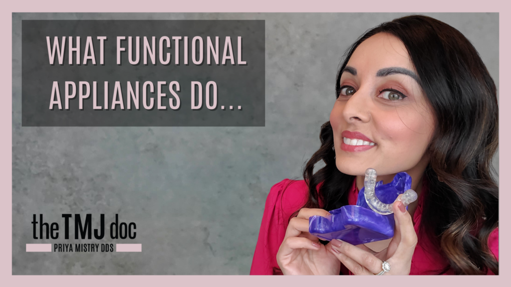 functional appliances